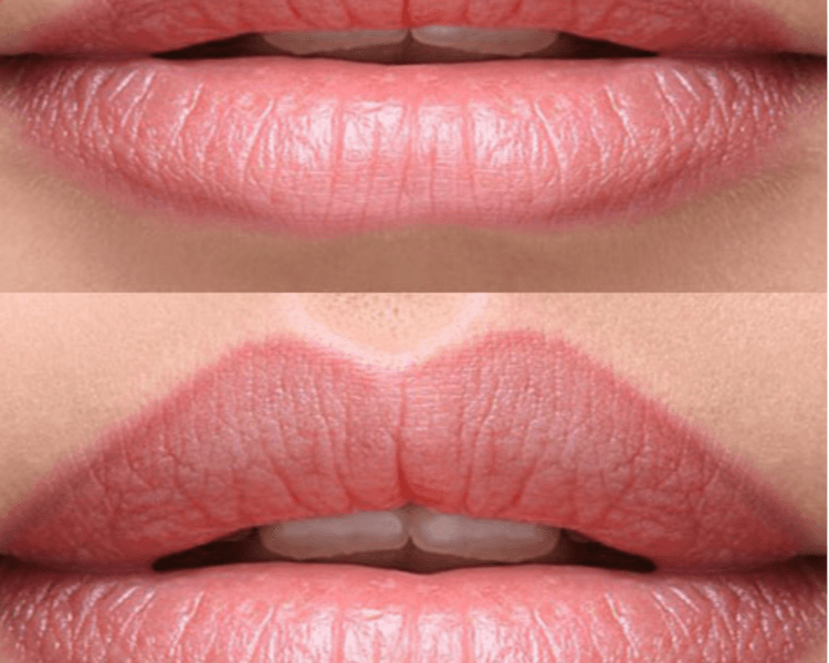 Delineado de Labios Permanente