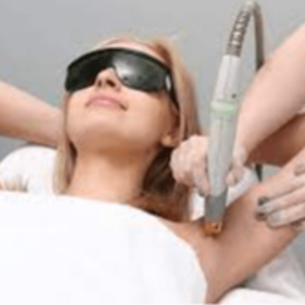 DEPILACION LASER FOTONA 8 SESIONES