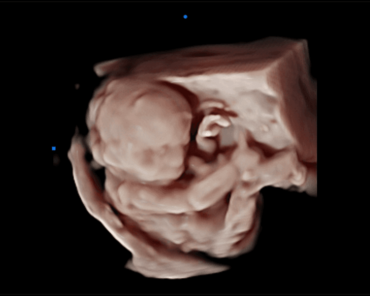 Revelación de sexo + 5D