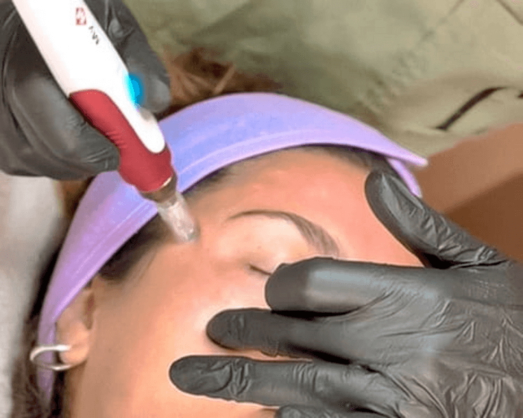 Limpieza Facial DELUXE - Antiage