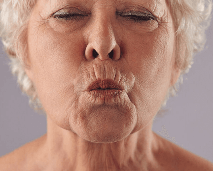 Arrugas de código de barras- Miomodulación