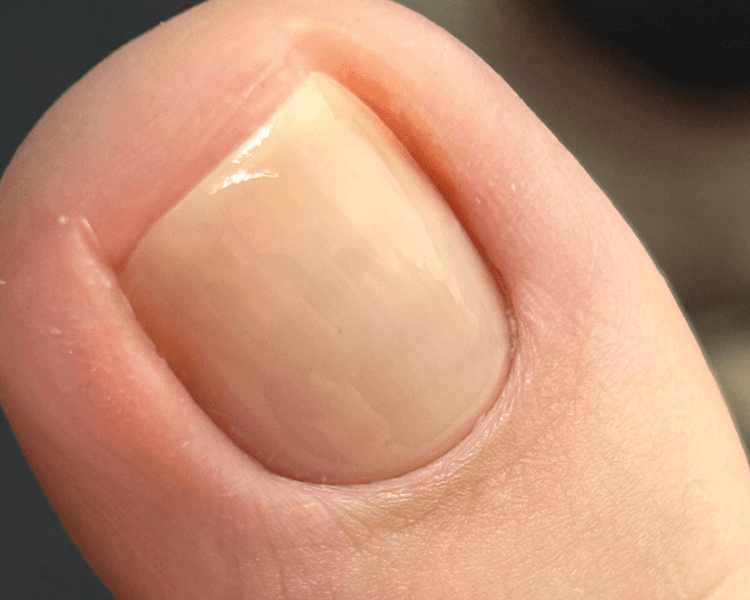 Pedicura sólo limpieza