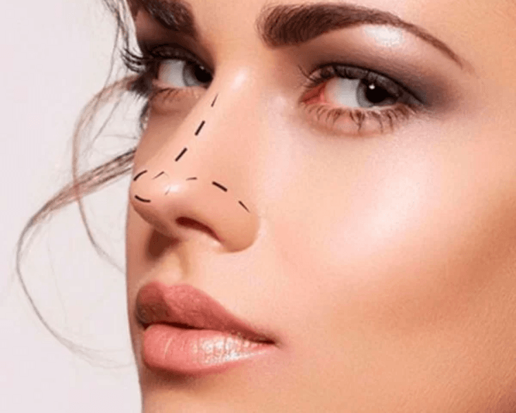 Pack Postoperatorio Rinoplastía