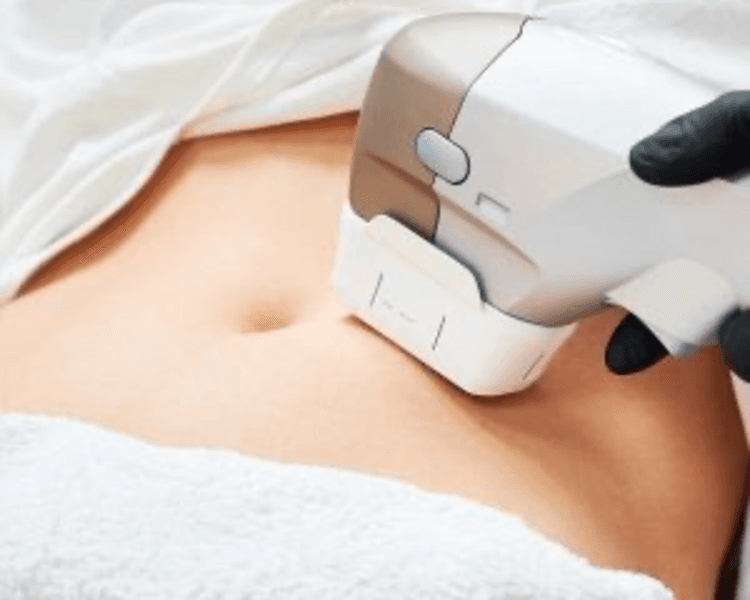 HIFU Corporal 12D - Reduce y Reafirma