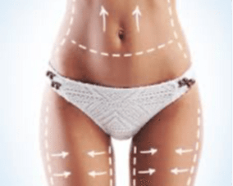 Tratamiento Corporal C