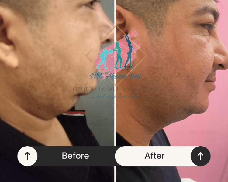 Terapia Dermatofuncional