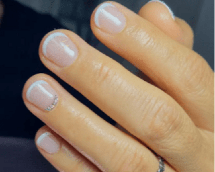 Capping con esmaltado sermipermanente