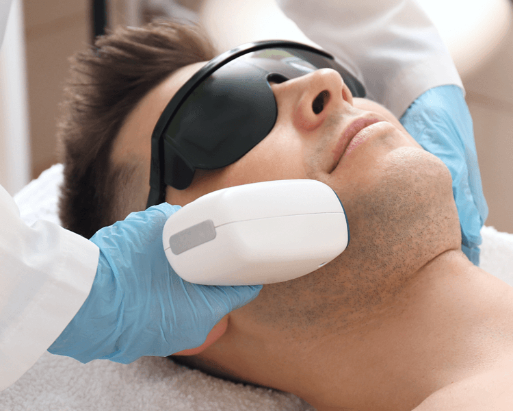 Depilacion Definitiva Cuerpo Completo Hombre + rostro