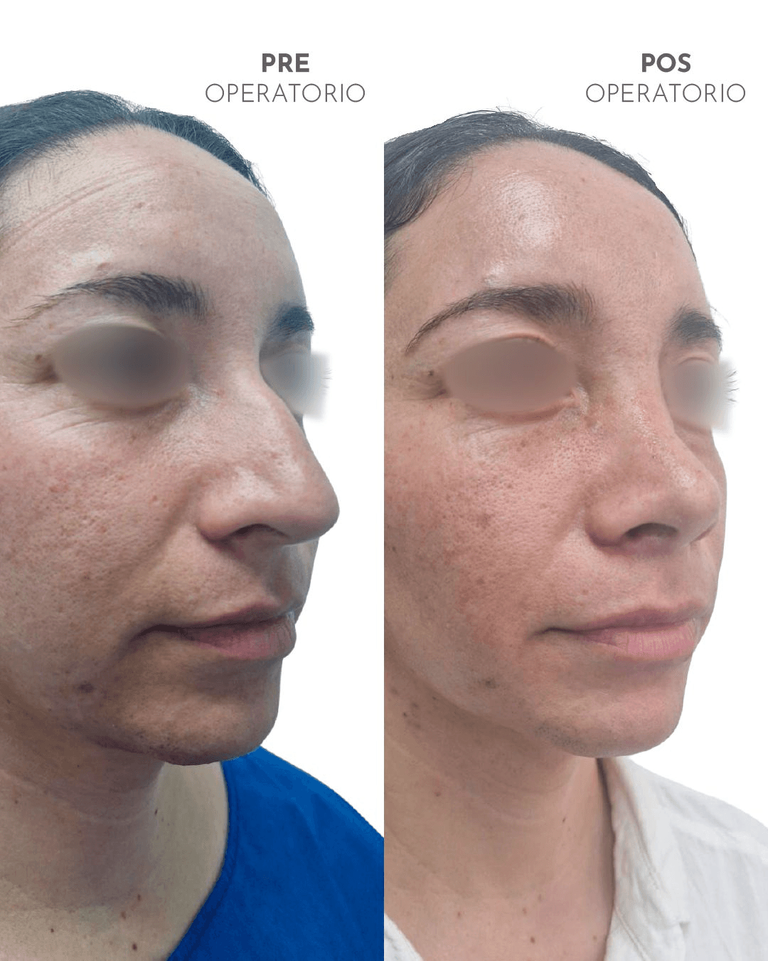 Masajes Postoperatorios photo