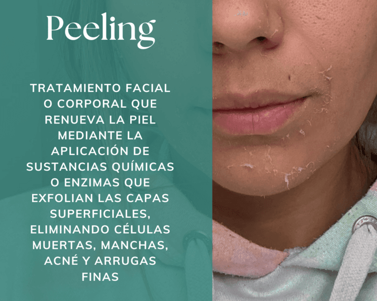Peeling Suave/Verano