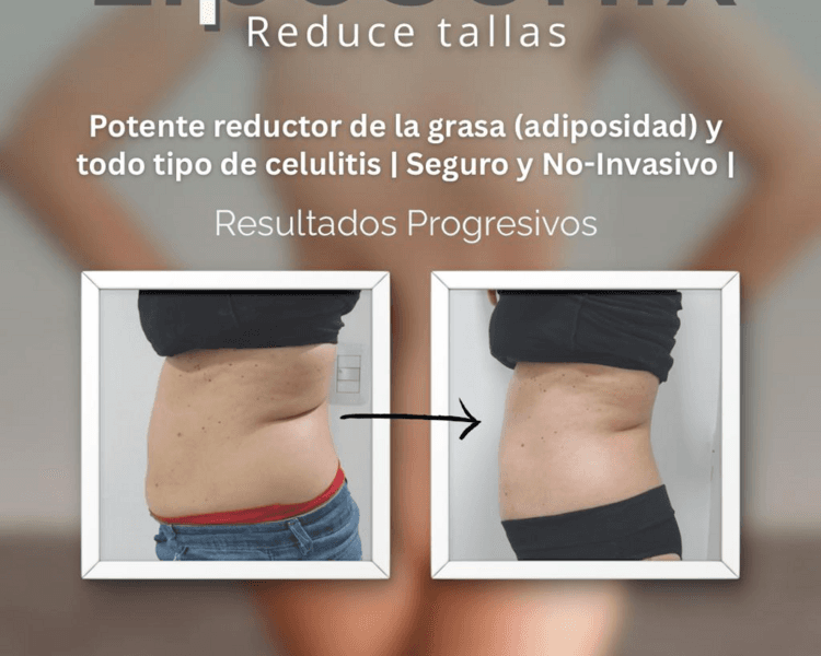 LipoSonix Abdomen + Flancos