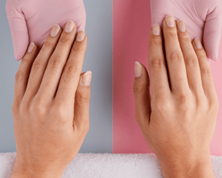 Retiro Esmaltado Permanenete