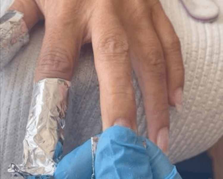 Retiro Semipermanente