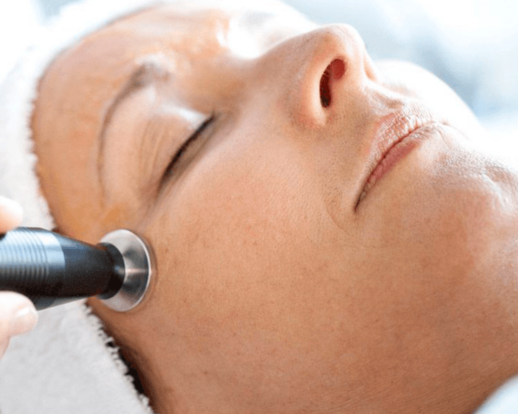 *Ultrasonido para contorno de ojos 20 Min.