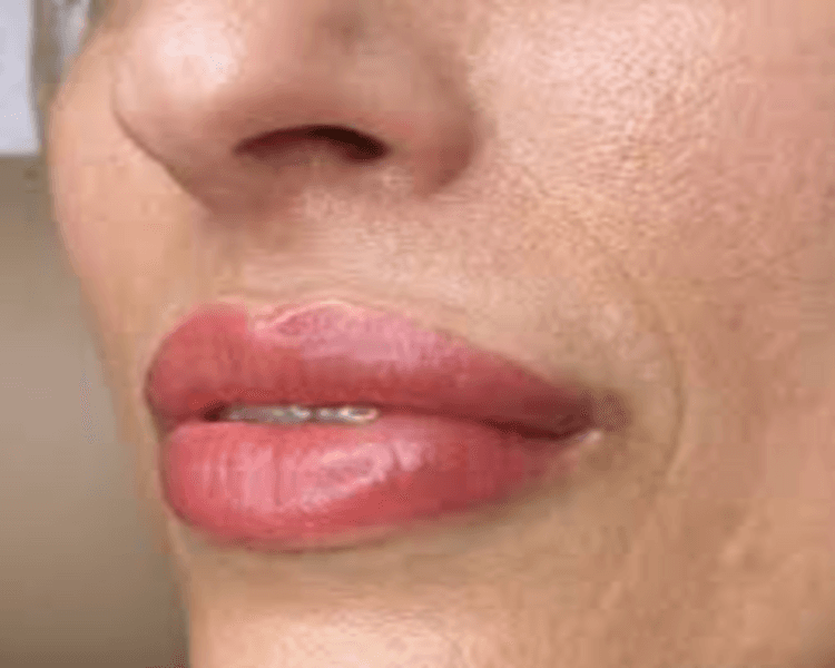 DERMOPIGMENTACION: DELINEADO Y RELLENO DE LABIOS