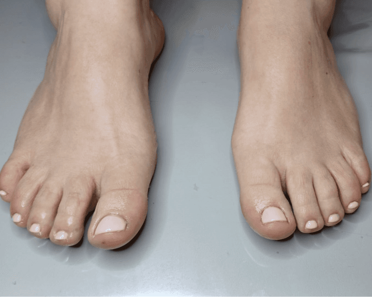 Belleza de pies