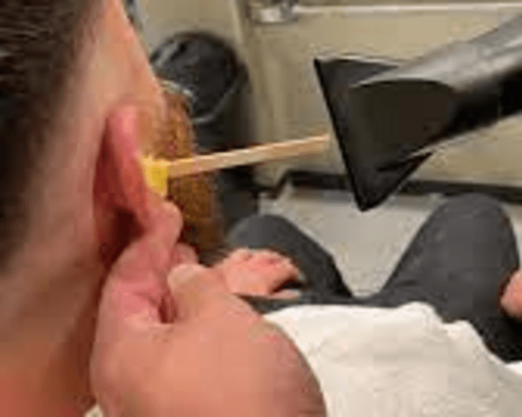 Depilación de Oídos