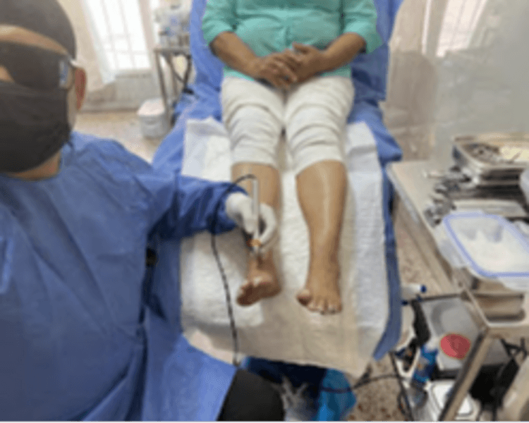 Onicomicosis con uso de laser