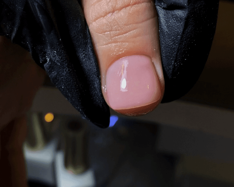 Reconstrucción de Uñas