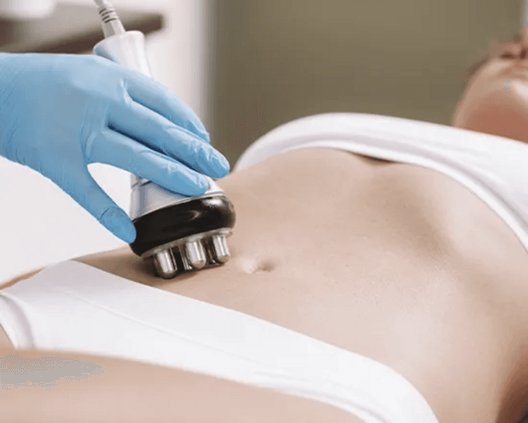 Pack Premium Corporal (10 sesiones): Cavitación + Lipoláser + Radiofrecuencia + Vacum