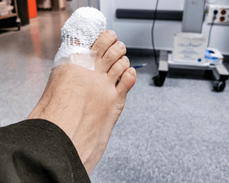 Curaciones de avanzada