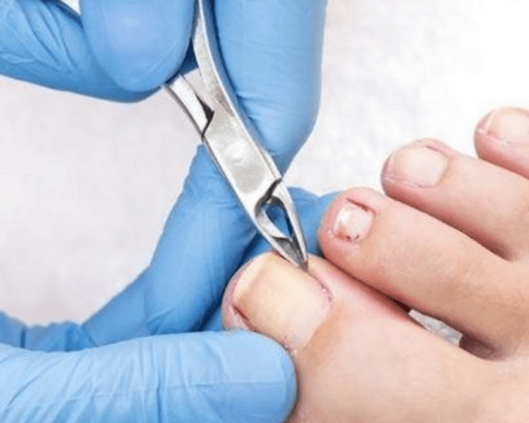 Podología clínica(Servicio a domicilio)