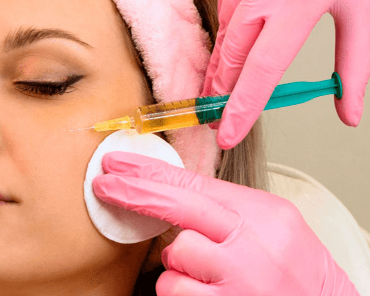 Plasma estético facial