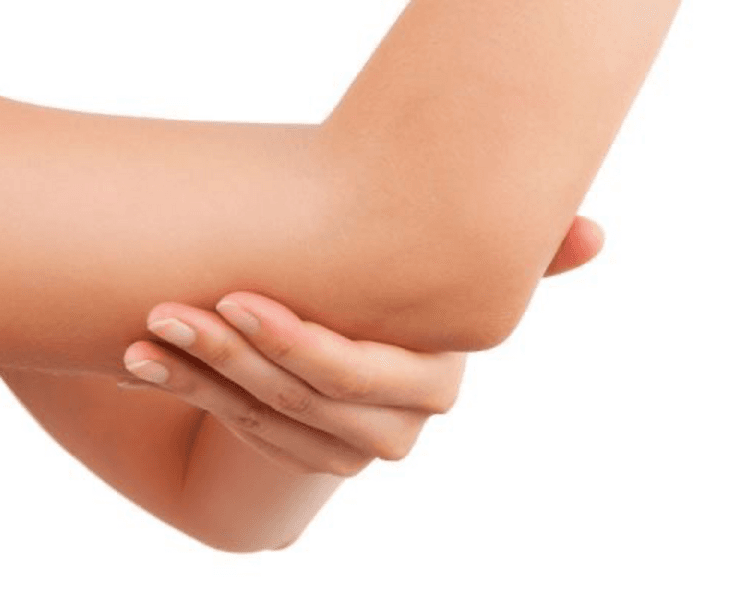 Despigmentación codos