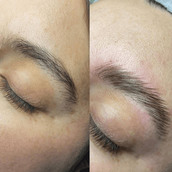 Brow Lamination