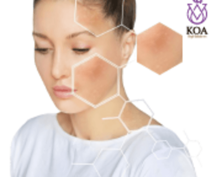 VALORACION MANCHAS SUPERFICIALES ROSTRO