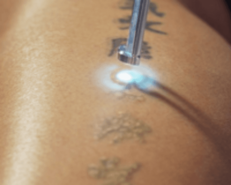 🀄️Eliminación Pequeño