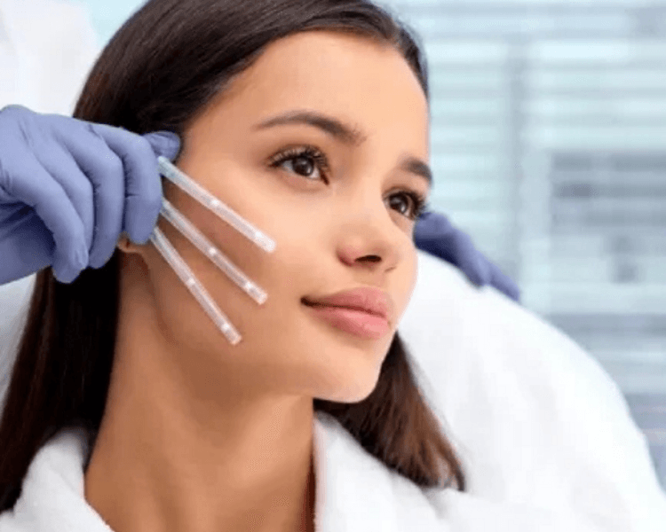 Lifting full face con Hilos de tracción (Tercio medio/inferior)