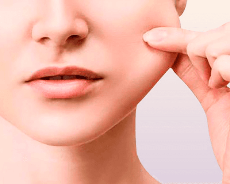 Bichectomía quirúrgica