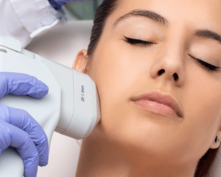 ULTRA HIFU 12D Mejilla + Papada + Demarcación mandibular, 30% OFF