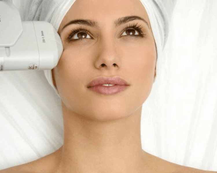 ULTRA HIFU 12D Frente + Contorno de ojos, 55% OFF