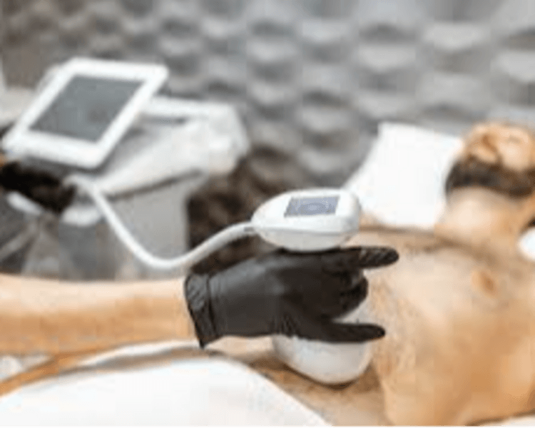 HIFU 14D PRO MAX CON LIPOSONIC : 3 ZONAS