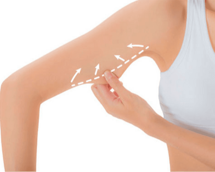 🔥 HIFU Corporal: Esculpí tu cuerpo sin cirugía 🔥 Alta intensidad, resultados visibles: Brazos