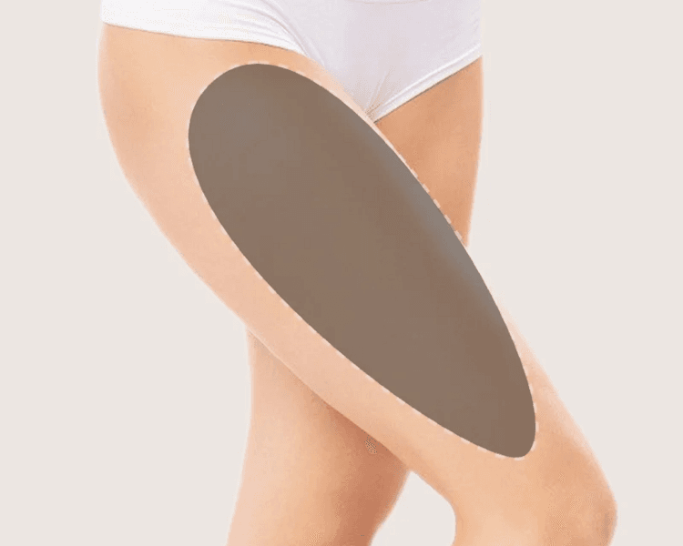 🔥 HIFU Corporal: Esculpí tu cuerpo sin cirugía 🔥 Alta intensidad, resultados visibles: Piernas