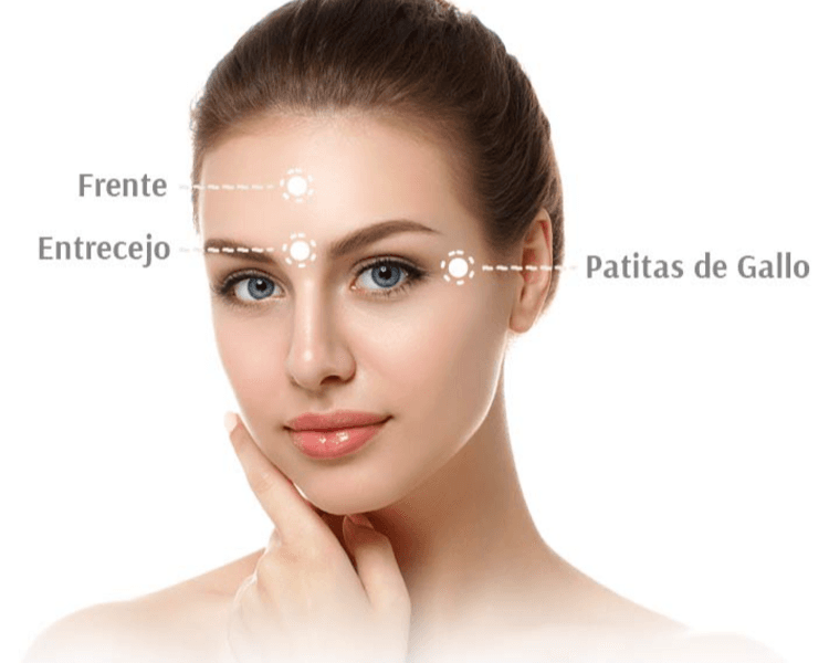 💉✨ Botox 3 Zonas