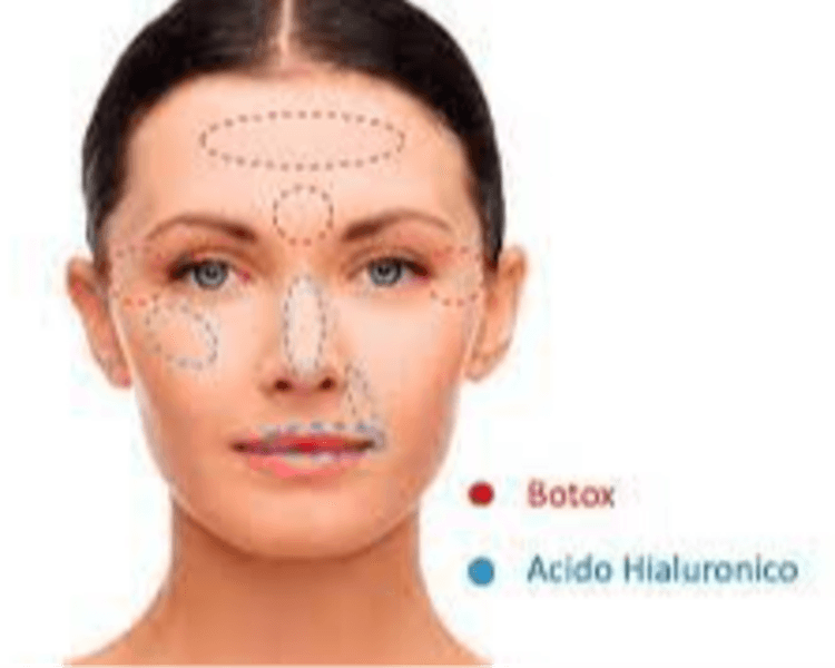 💫 Full Face / Armonización Facial