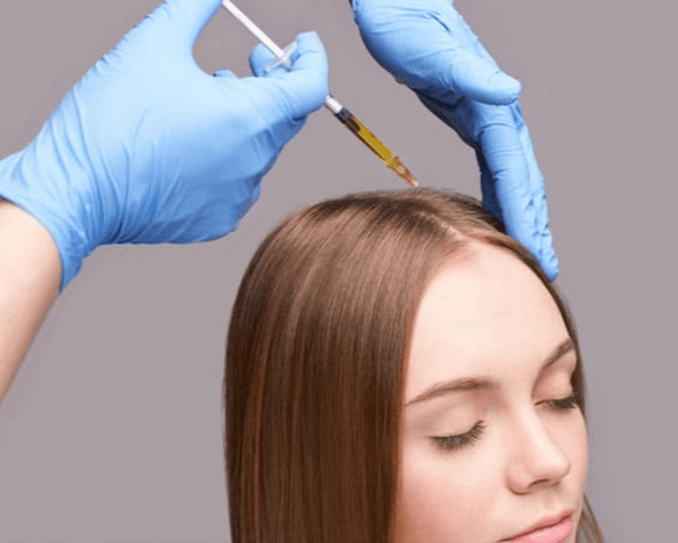 💆♂️💉Mesoterapia capilar