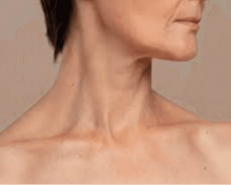 ✨ Plasma Facial + Cuello + Escote