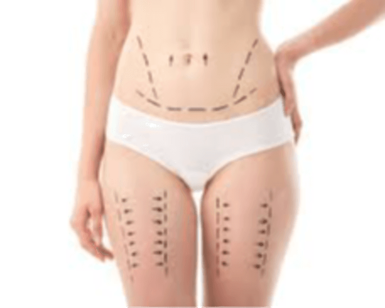 💪✨ Máxima Tonificación Firmeza real, resultados visibles y piel más definida 🔥(Body up+ maderoterapia+ crioradiofrecuencia)