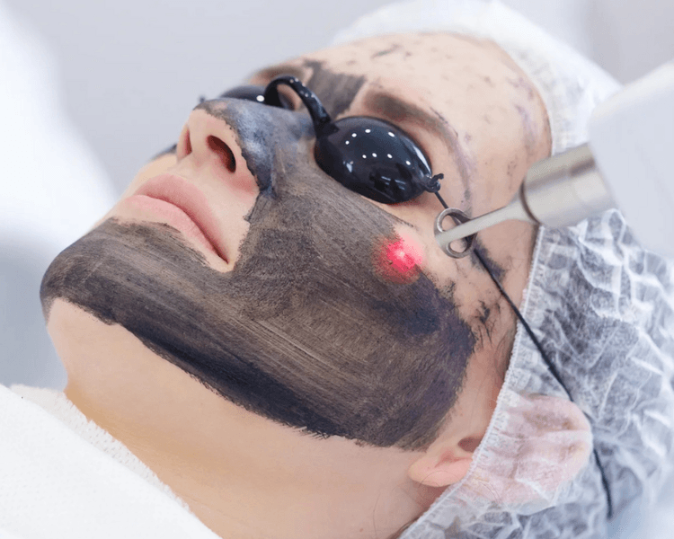 Hollywood Pink (hollywood peel + mesoterapia con pink glow)