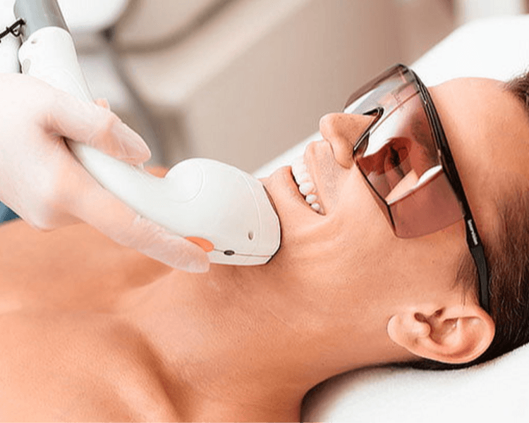 Depilación Laser Pomulos