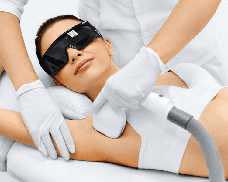 Depilación Laser Axilas