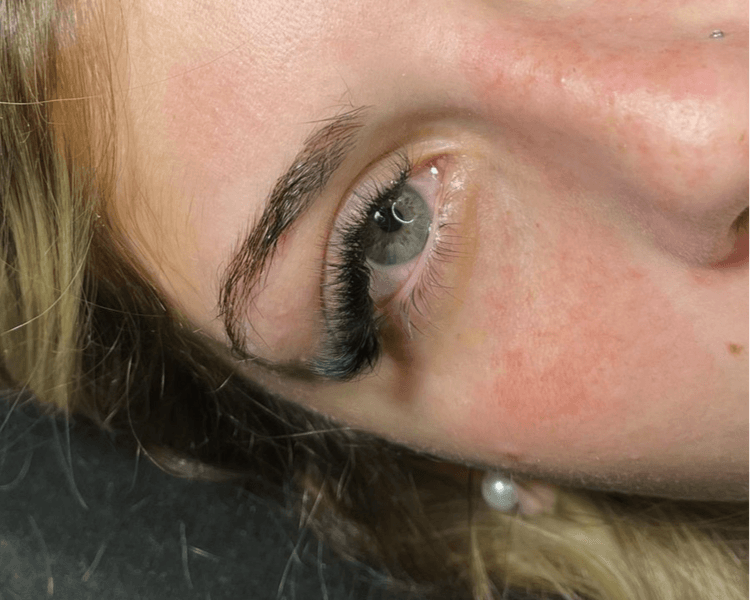 Capping megavolumen 6D