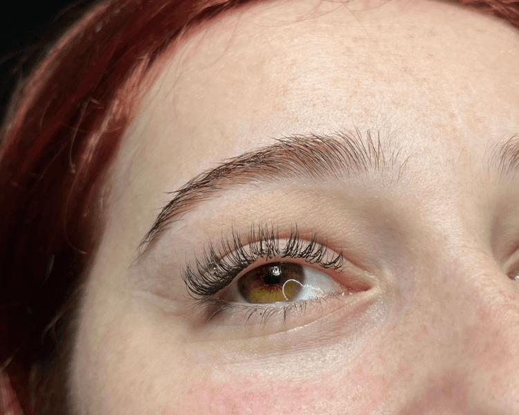 Extensiones clasicas