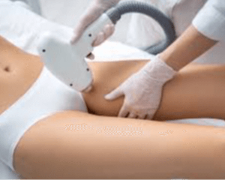 Depilación Laser Gluteos