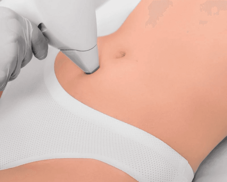 Depilación Laser Línea Alba